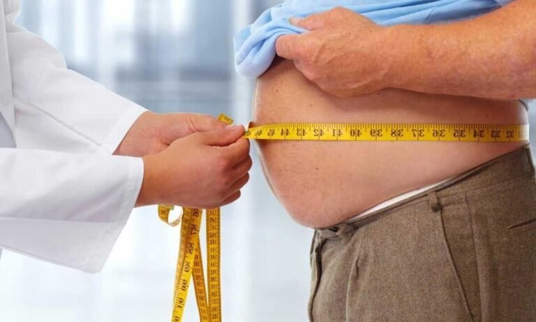 Obesity: Awareness, Prevention and Practical Steps Obesity: Awareness, Prevention and Practical Steps