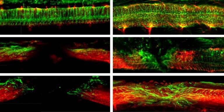 Mouse with Severed Spinal Cord Recovers ‘Normal’ Movement After Potentially Revolutionary Treatment Mouse with Severed Spinal Cord Recovers ‘Normal’ Movement After Potentially Revolutionary Treatment