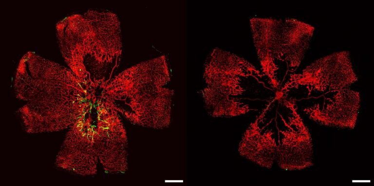 Blind People Offered Hope of Seeing Again After Stem Cell Breakthrough Remakes Retinal Blood Vessels Blind People Offered Hope of Seeing Again After Stem Cell Breakthrough Remakes Retinal Blood Vessels