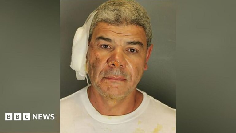 A mug shot of Soliman wearing a white shirt with bandage on his ear